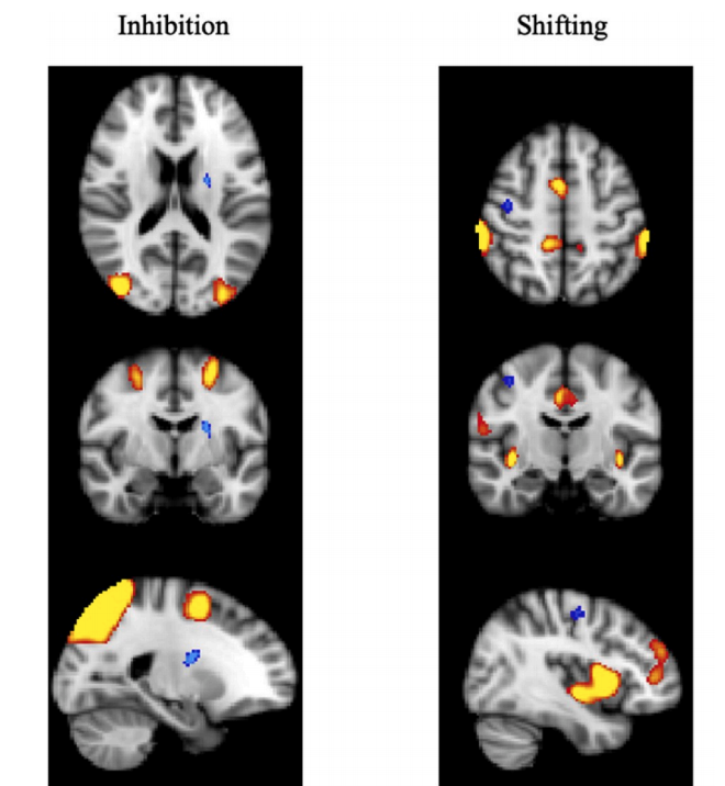 Relationships between multiple dimensions of executive functioning and resting-state networks in adults